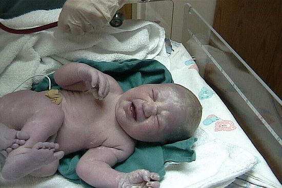 Click on image for details