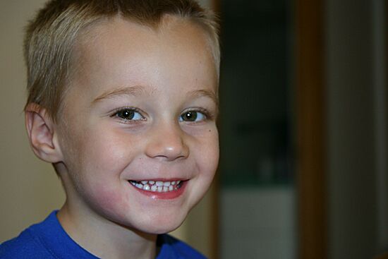 Click on image for details